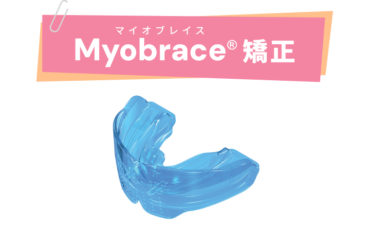 小児矯正｜名古屋市中川区の歯医者-おしむら歯科